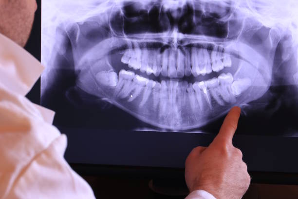 Best Emergency Treatment for Jaw Pain or Injury in Clearlake Riviera, CA