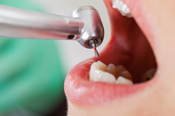 Best Walk-In Emergency Dental Services in Clearlake Riviera, CA